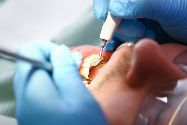 Best Emergency Gum Treatment in Fox Lake, IL