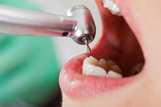 Best Emergency Dental Care for Broken or Chipped Teeth in Fox Lake, IL